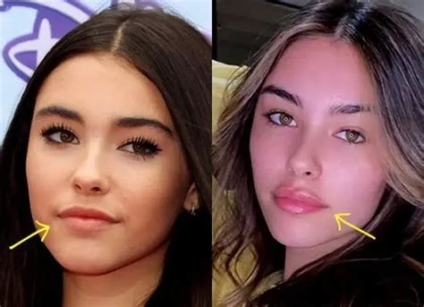 does madison beer have a boob job|Madison Beer Plastic Surgery: Quotes, Before, After。